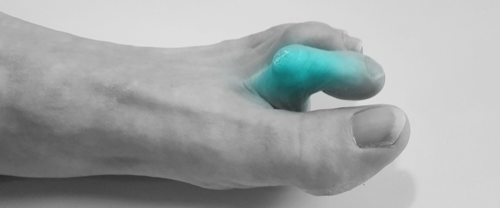 Your Feet May Be Telling You Something: Causes of Claw Toe Deformity