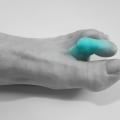 Your Feet May Be Telling You Something: Causes of Claw Toe Deformity